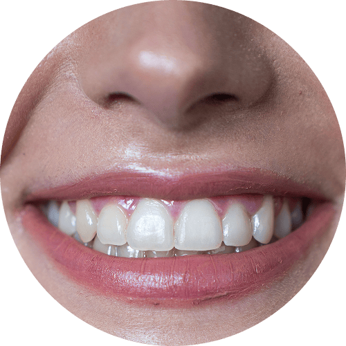 resultados previsiveis